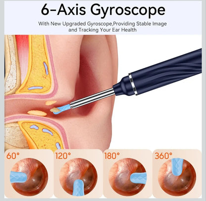 Ear Wax Removal Tool Smart Ear Cleaner Ear Camera Scope with Light Smartphone Ear HD Video Otoscope Wax Cleaner